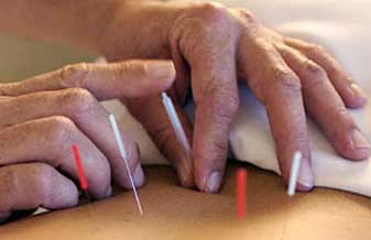 Dr. Colonna Acupuntura - Foto 1