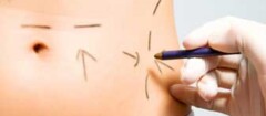 cirurgia-plastica-araruama-1371056069