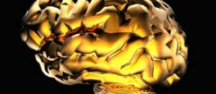 neurologia-araruama-1371150099