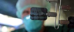 radiografia-odontologia-araruama-1371158125